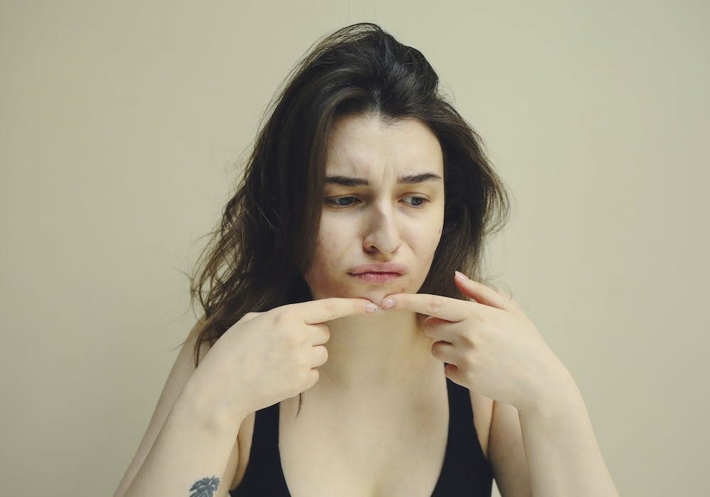 Ursachen für Pickel und was dagegen hilft