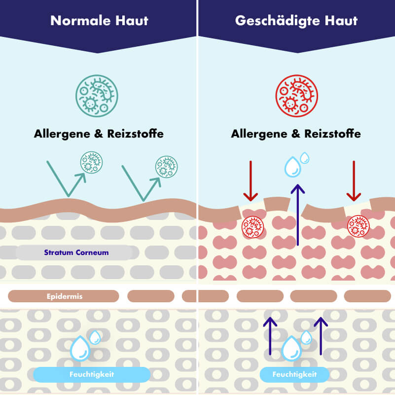 Infografik normale vs. geschädigte Haut
